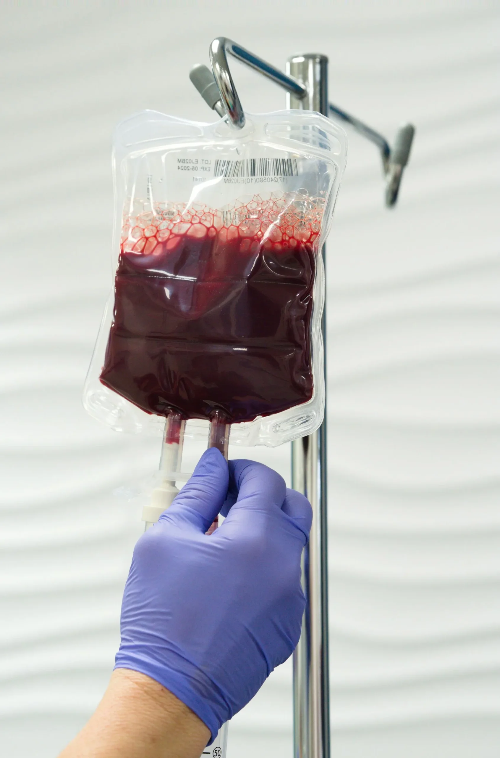 Benefits of Ozone Therapy