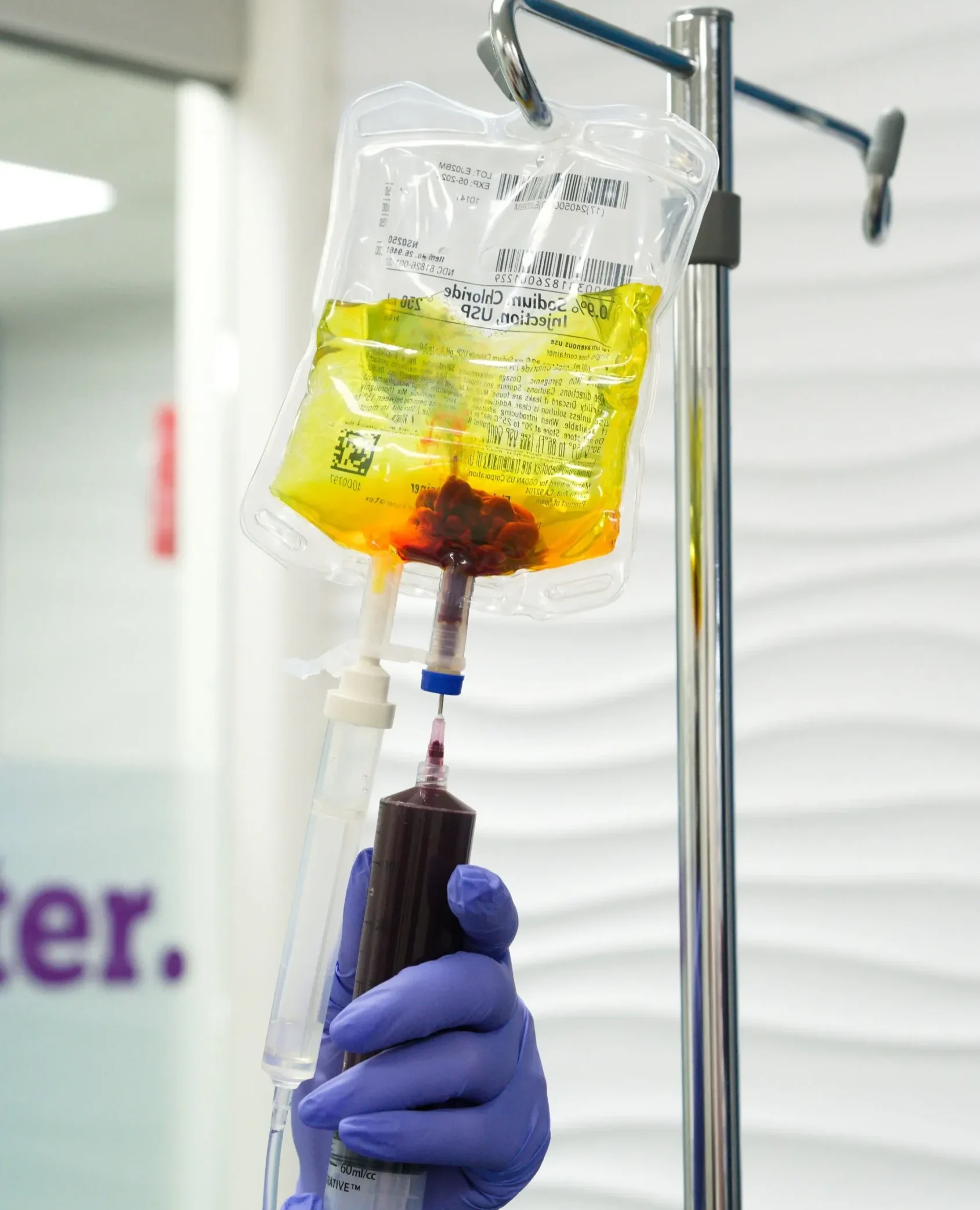 Ozone Therapy