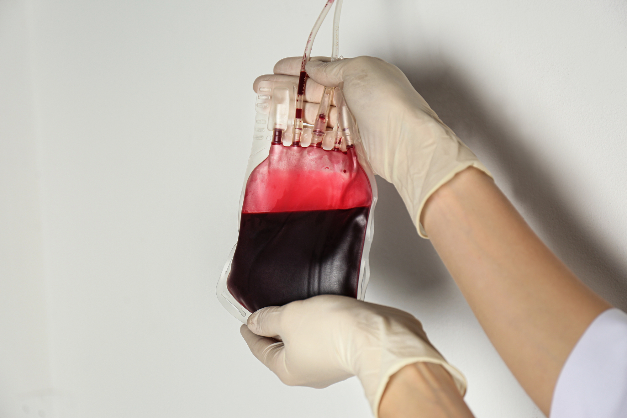 Ozone Therapy: A Novel Approach to Joint Pain Relief