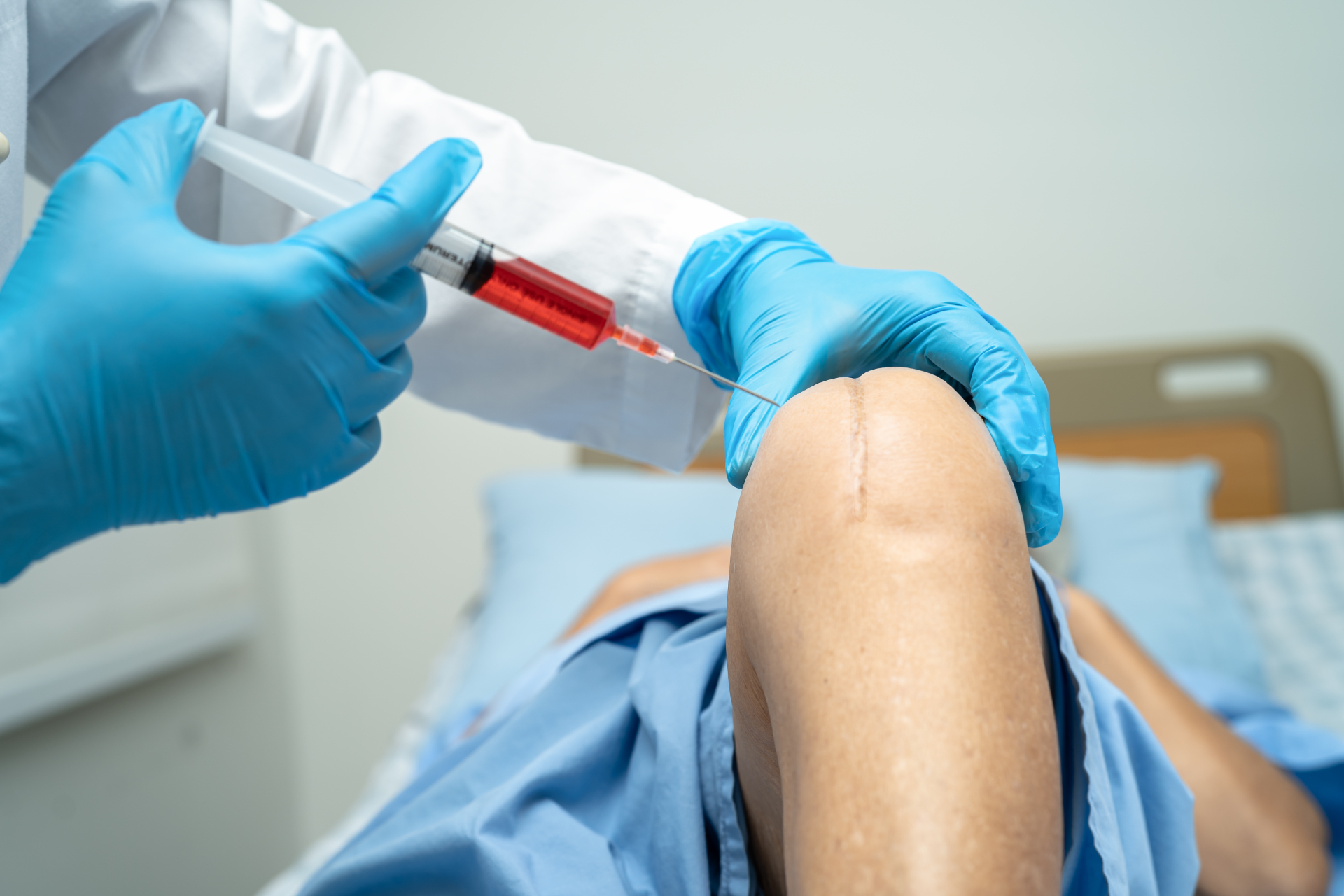 The Benefits of PRP Injections for Joint Repair