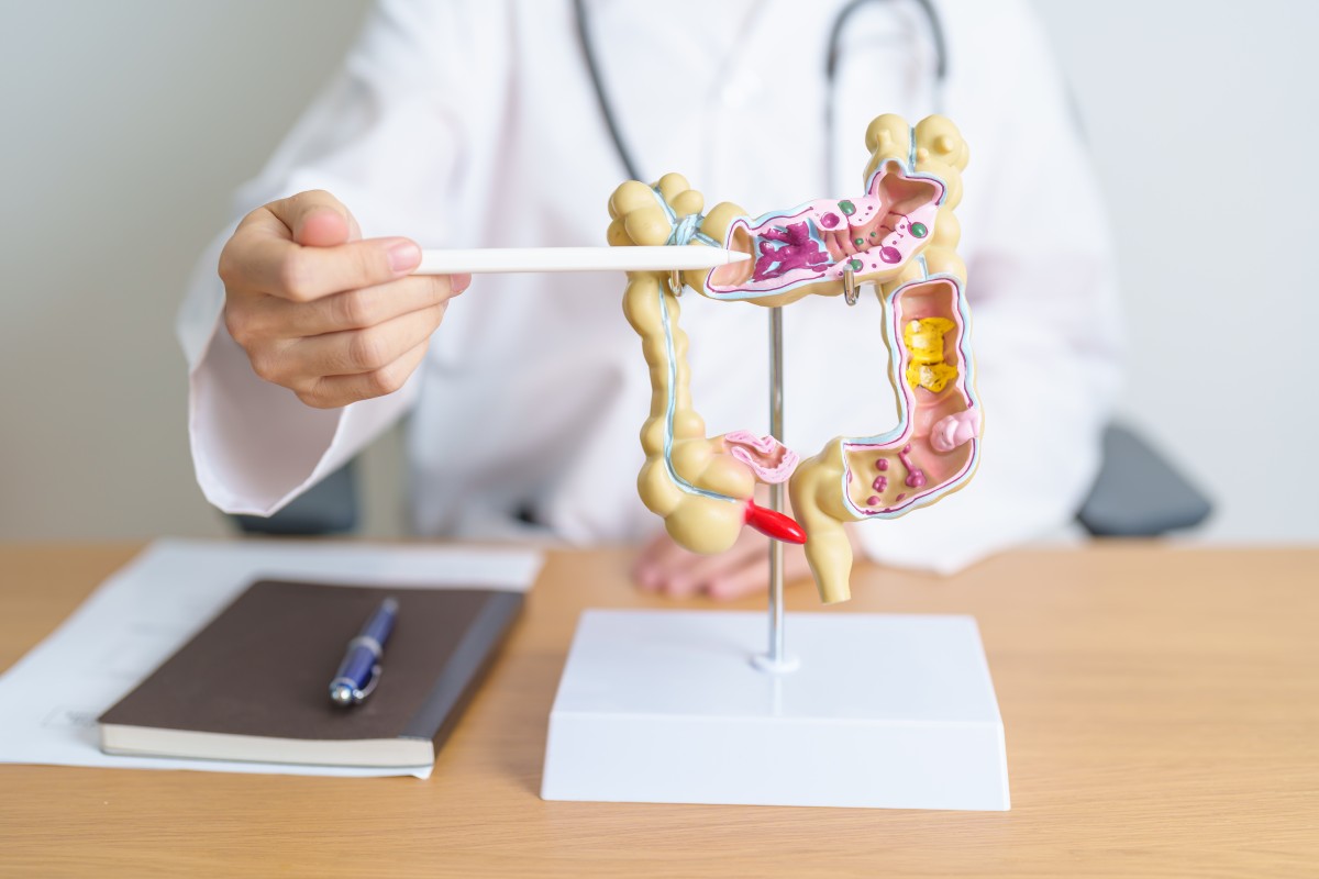 Decoding the Microbiome: How Gut Tests Unlock Personalized Longevity Plans